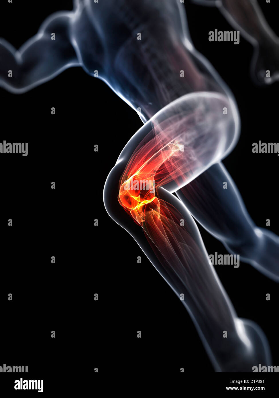 Running injury, conceptual artwork Stock Photo - Alamy