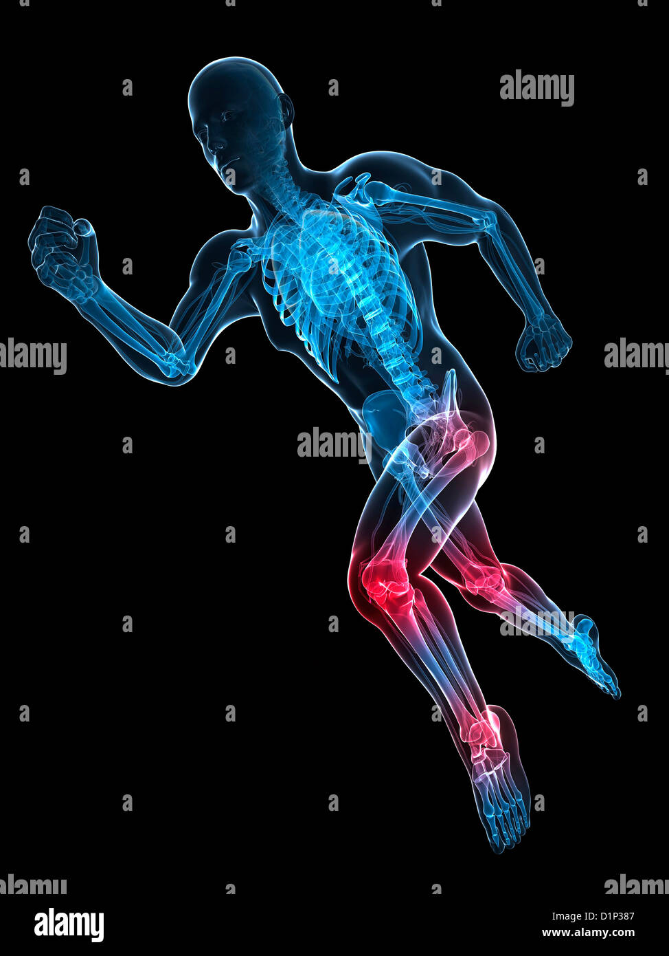 Running injuries, conceptual artwork Stock Photo