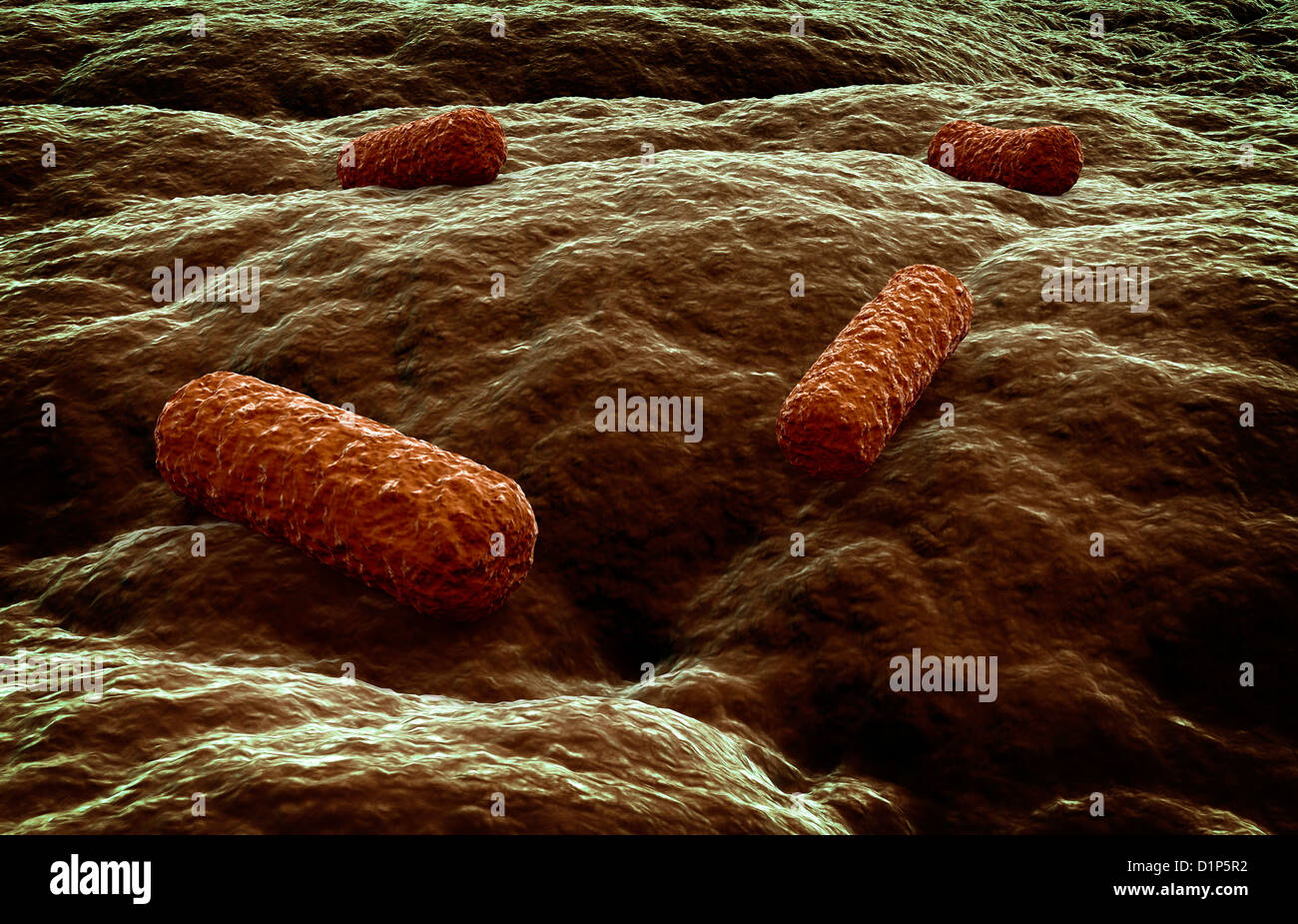 Bacterial infection, artwork Stock Photo