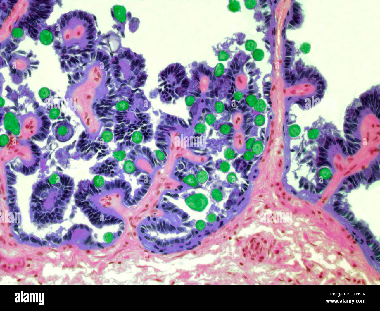 Coccidiosis, light micrograph Stock Photo