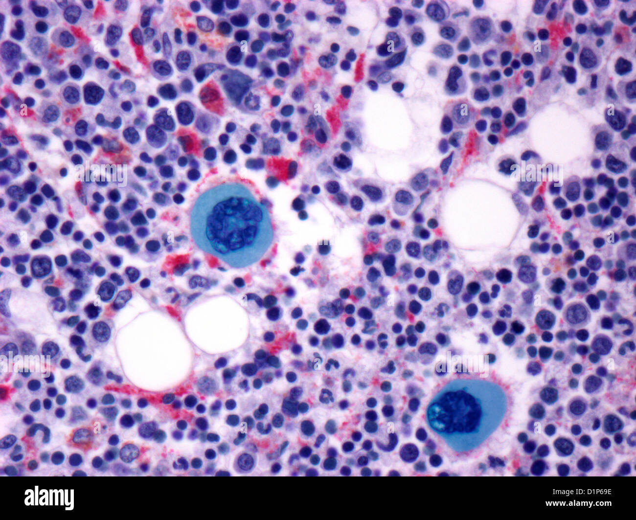 Bone marrow, light micrograph Stock Photo