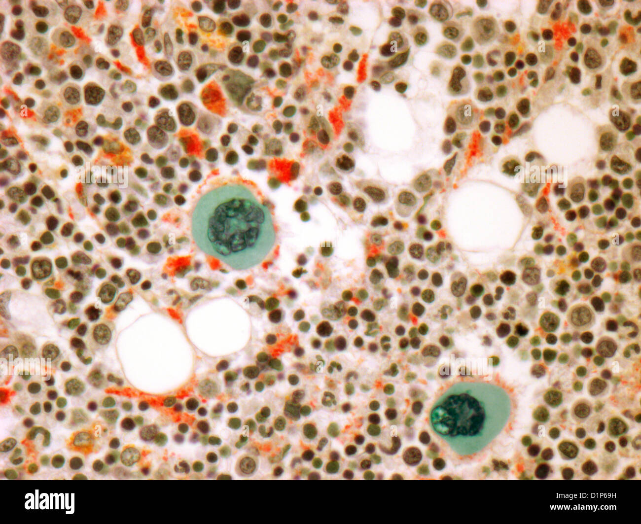 Bone marrow, light micrograph Stock Photo