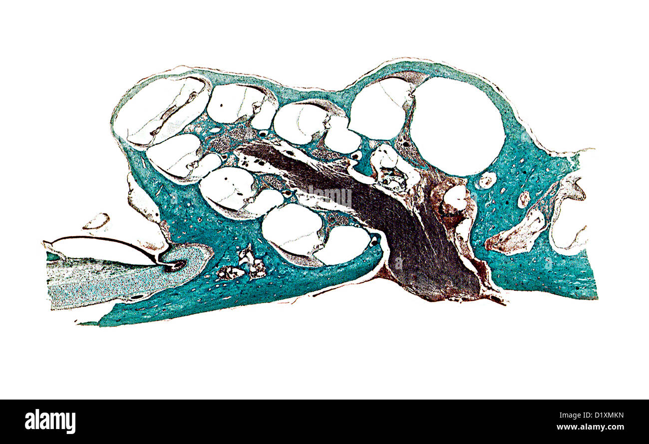 Microscope vertical section of the cochlea in the ear Stock Photo Alamy