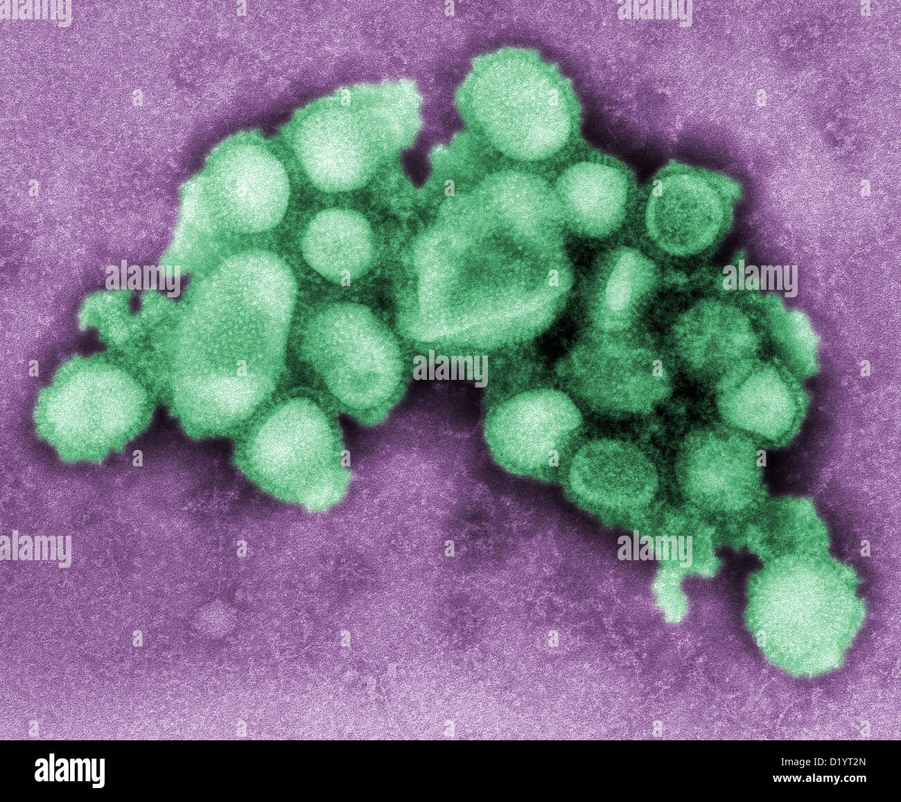 This negative stained transmission electron micrograph (TEM) of the ultrastructural morphology of the A/CA/4/09 wine flu virus Stock Photo