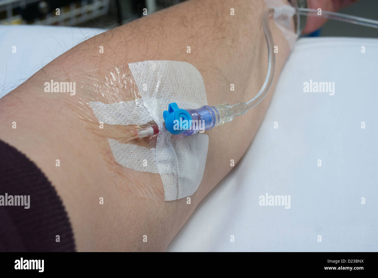 Medical cannula in patient's arm Stock Photo
