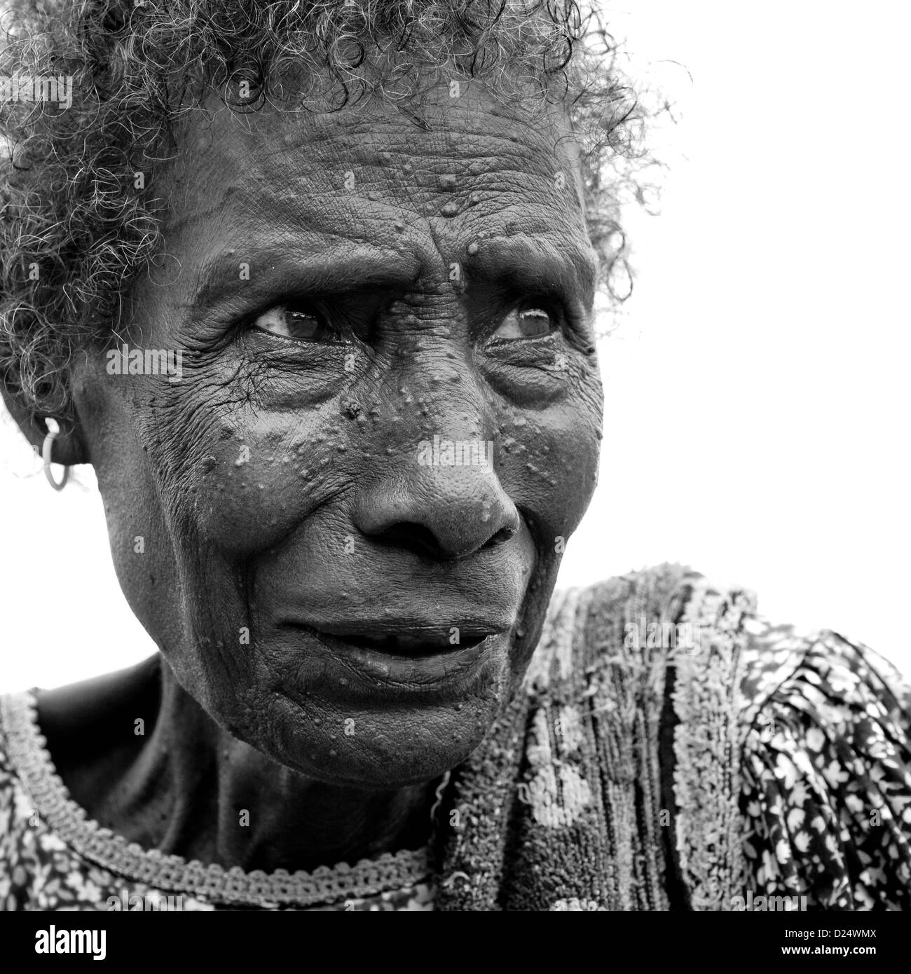 Woman From Autonomous Region Of Bougainville In Traditionnal Clothes, Papua New Guinea Stock Photo