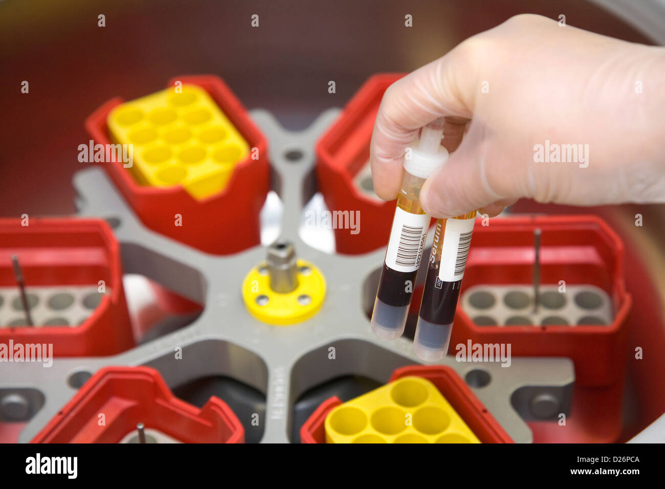 Essen, Germany, in the cytology laboratory blood test at a hospital Stock Photo