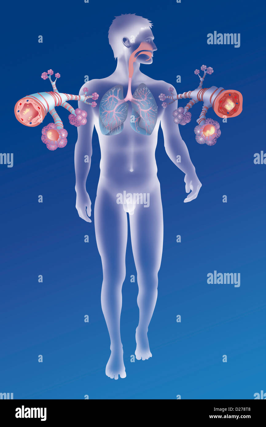 ASTHMA, DRAWING Stock Photo Alamy