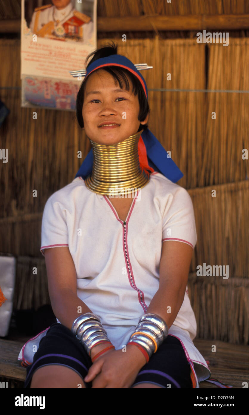 Thailand. Chiang Rai Region. Padong Hill Tribe Villager With Neck