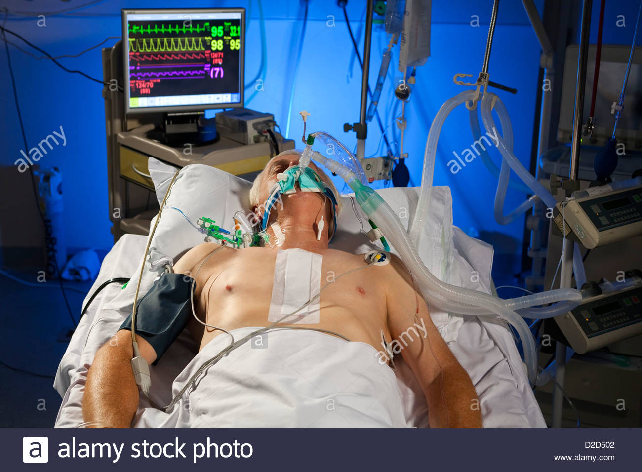 Ventilator Patient High Resolution Stock Photography and Images Alamy
