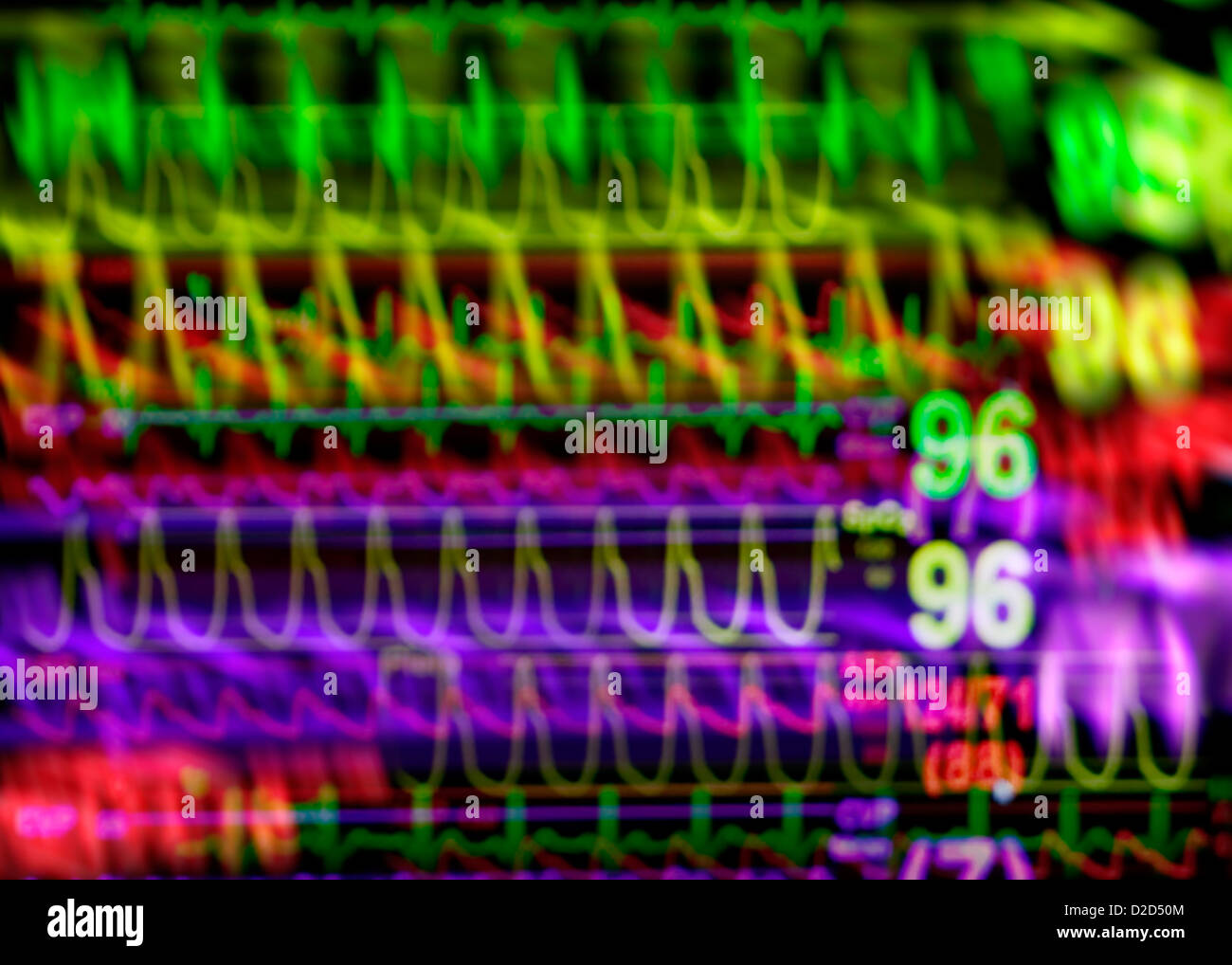 Vital signs monitor Stock Photo Alamy