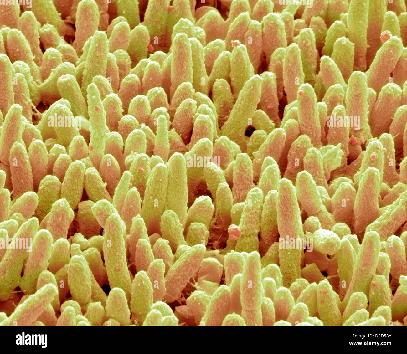 Bacterial Plaque