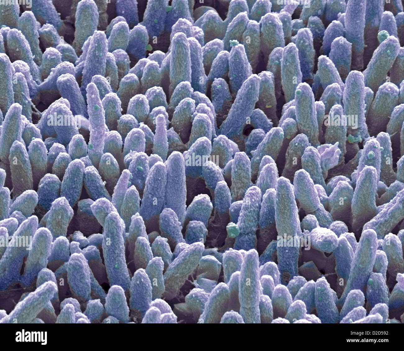 Dental plaque Coloured SEM of dental plaque Plaque consists of a film