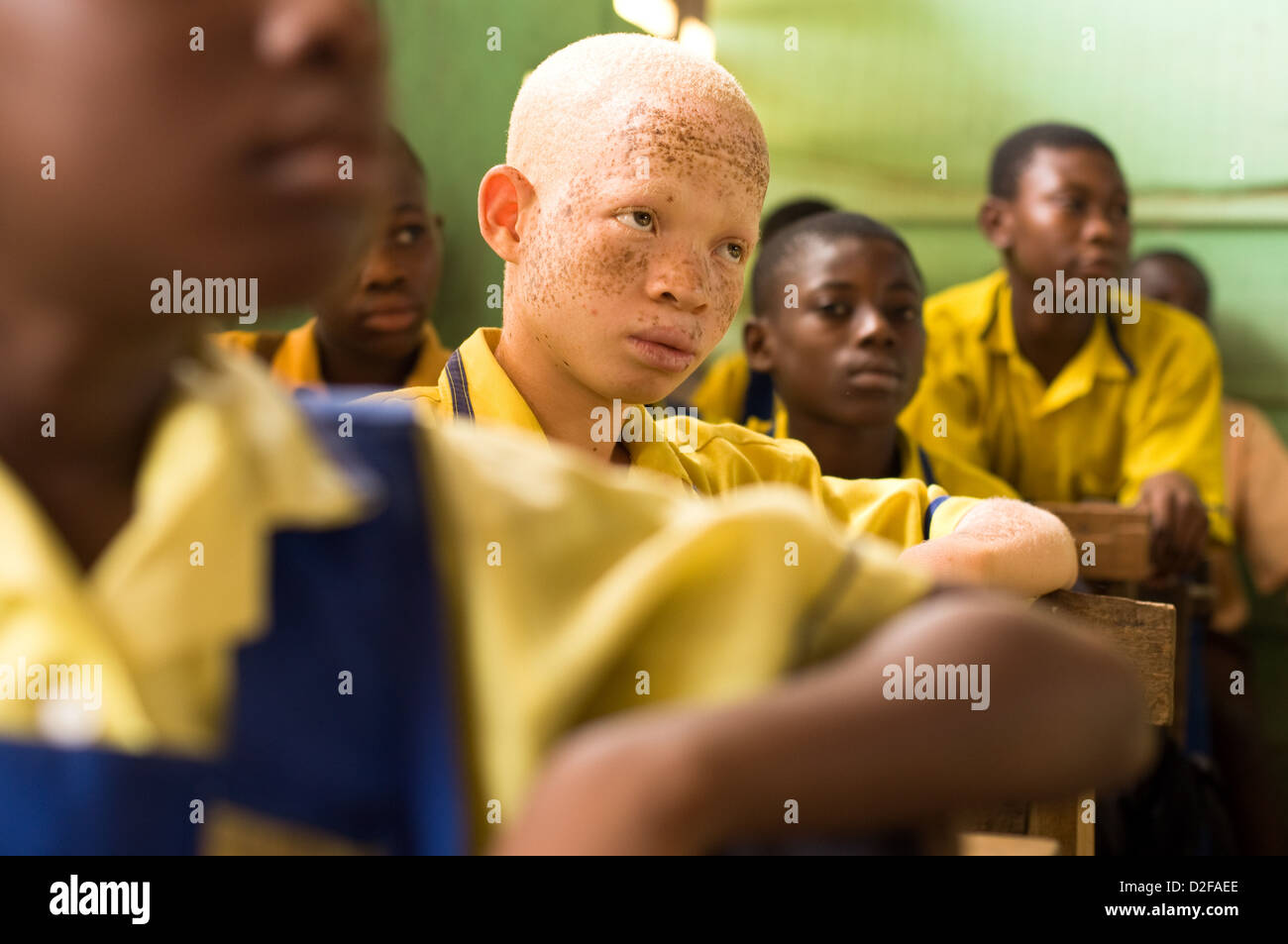 Albino boy hi-res stock photography and images - Alamy