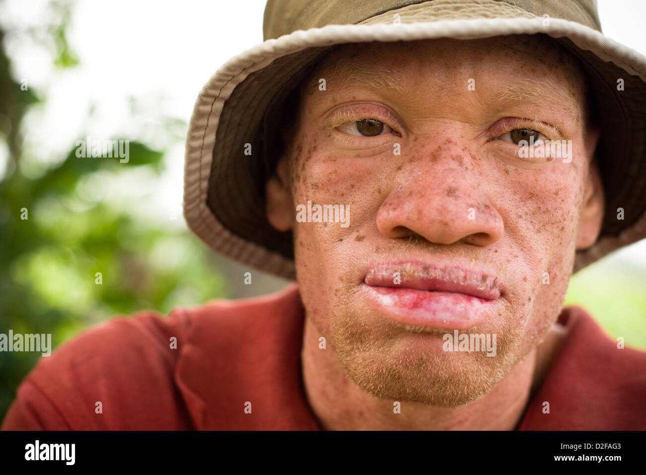 Portrait of an african albino man wearing a hat. Stock Photo