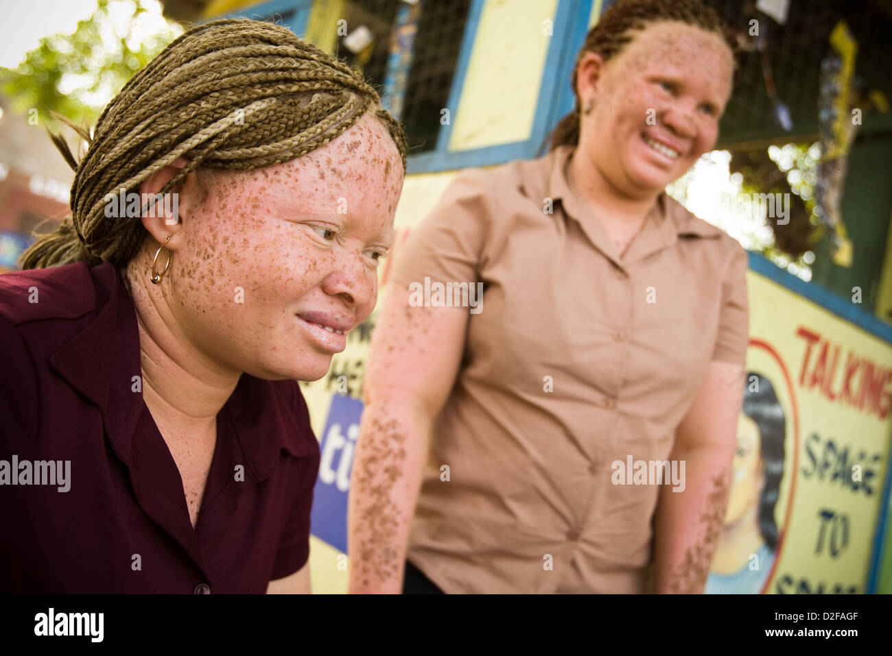 African albino sisters. Stock Photo