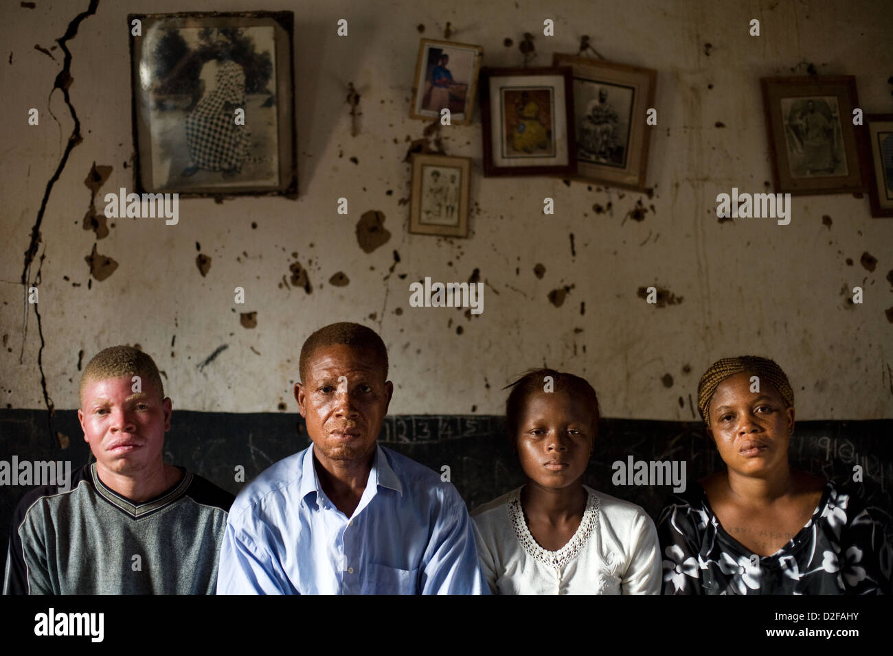 Family portrait of african albinos. Stock Photo