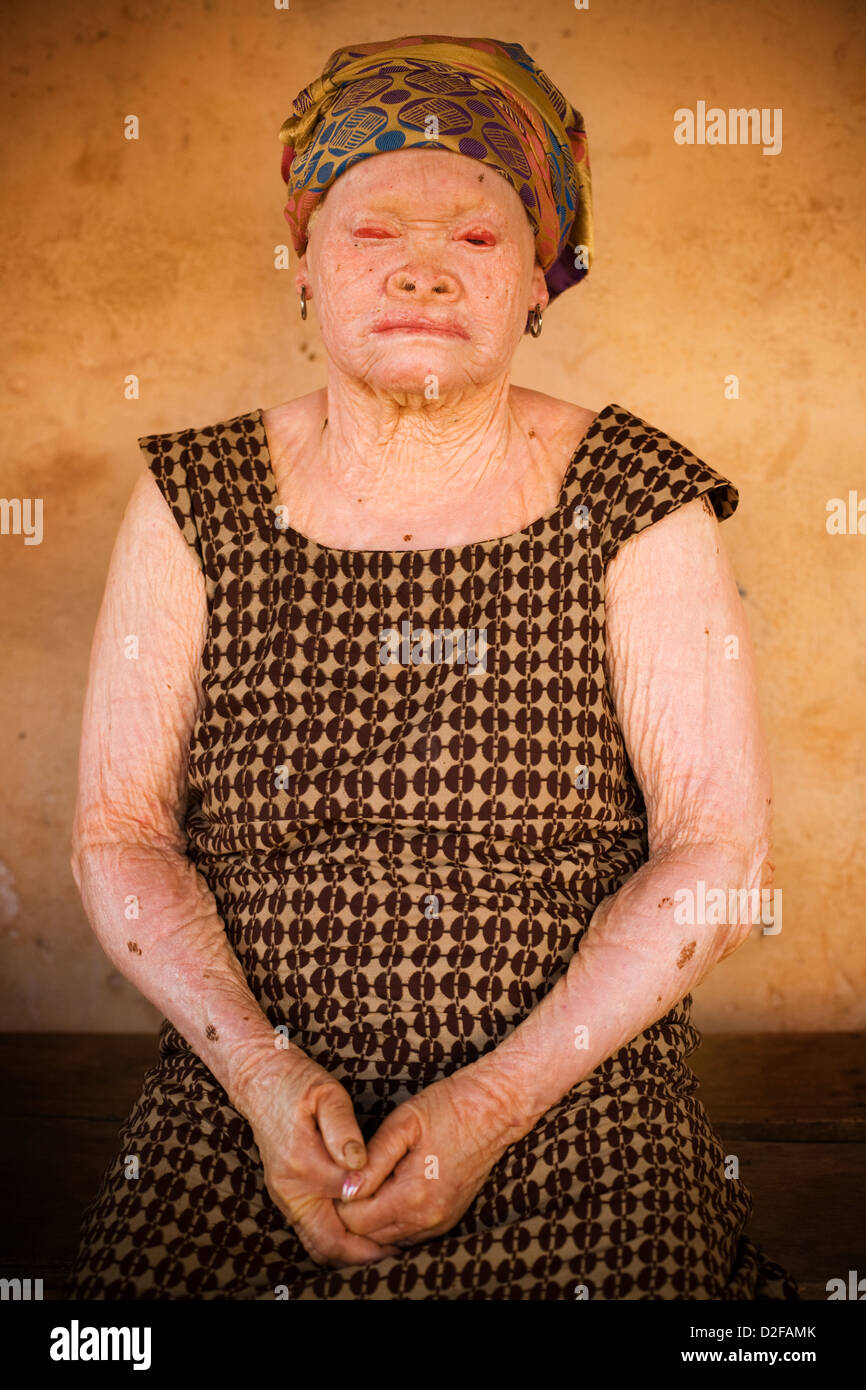 Portrait of elderly african albino woman. Stock Photo