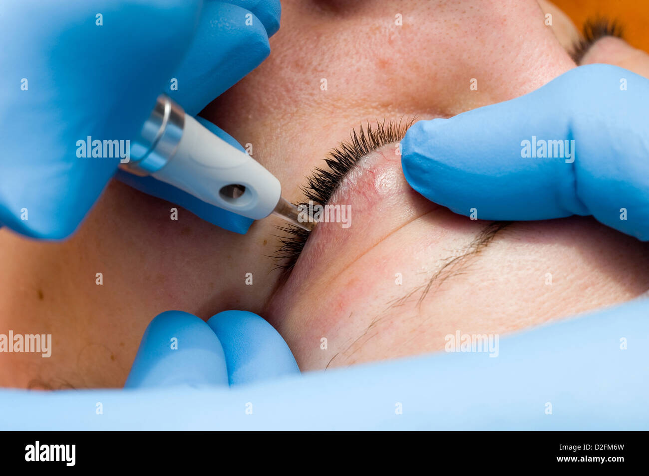A woman is getting permanent make-up with a needle in a beauty salon Stock Photo