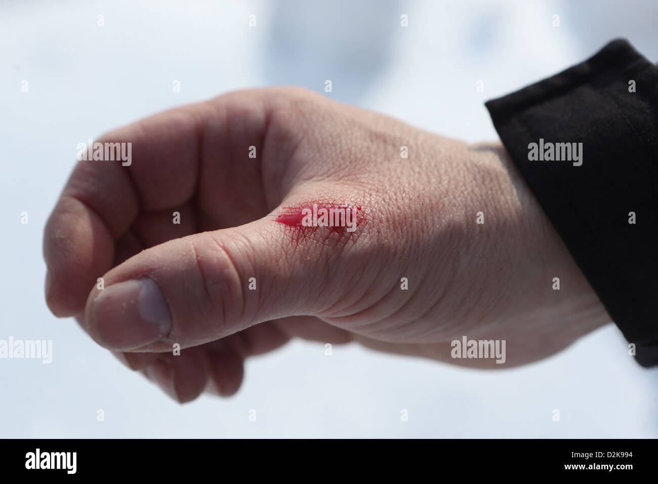 Wandlitz, Germany, bleeding wound on a hand Stock Photo