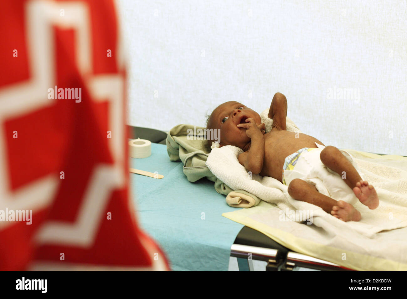 Carrefour, Haiti, a sick infant lies on a stretcher and screams Stock Photo