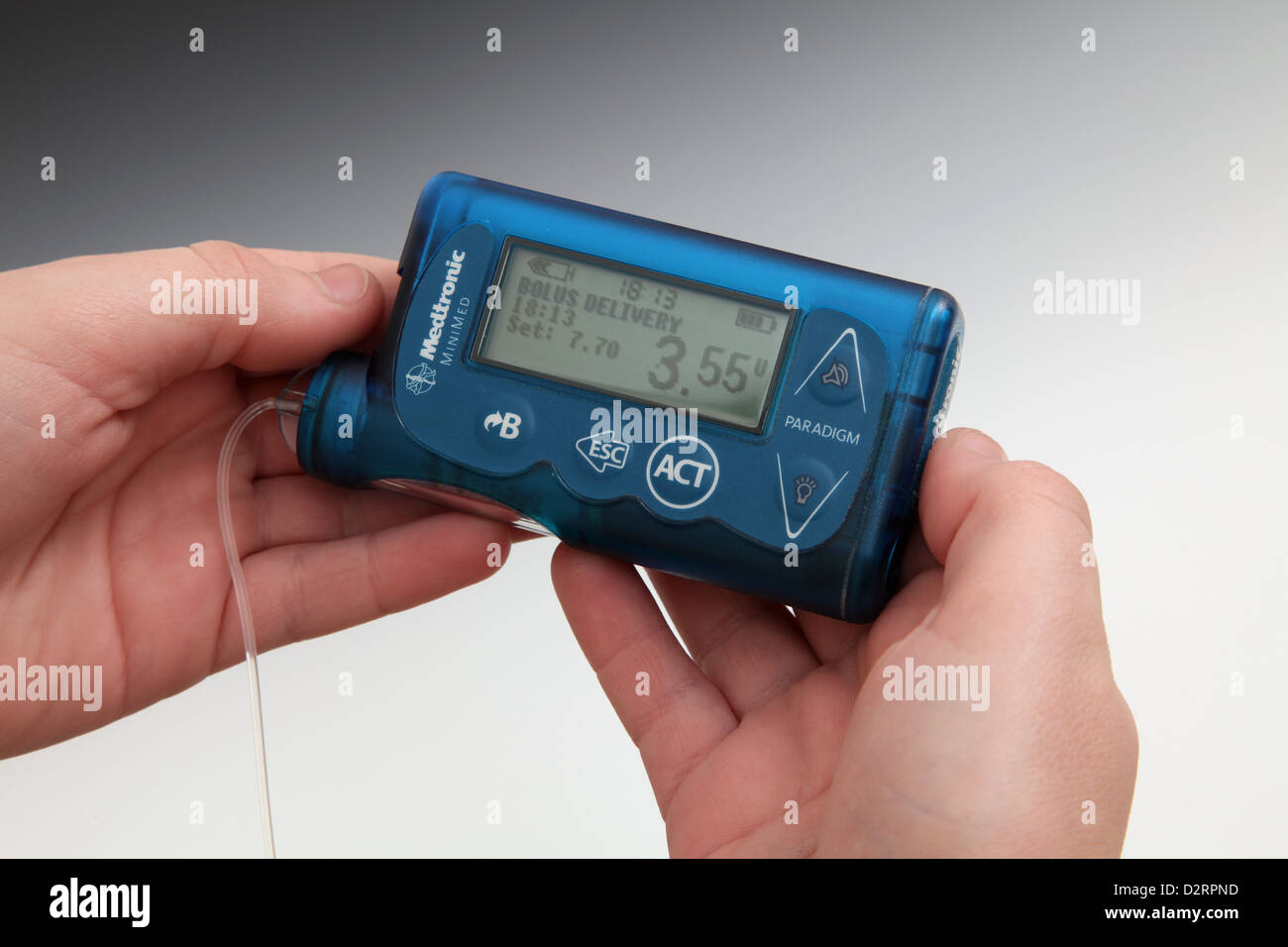 Child holidng diabetic Insulin Pump Stock Photo Alamy