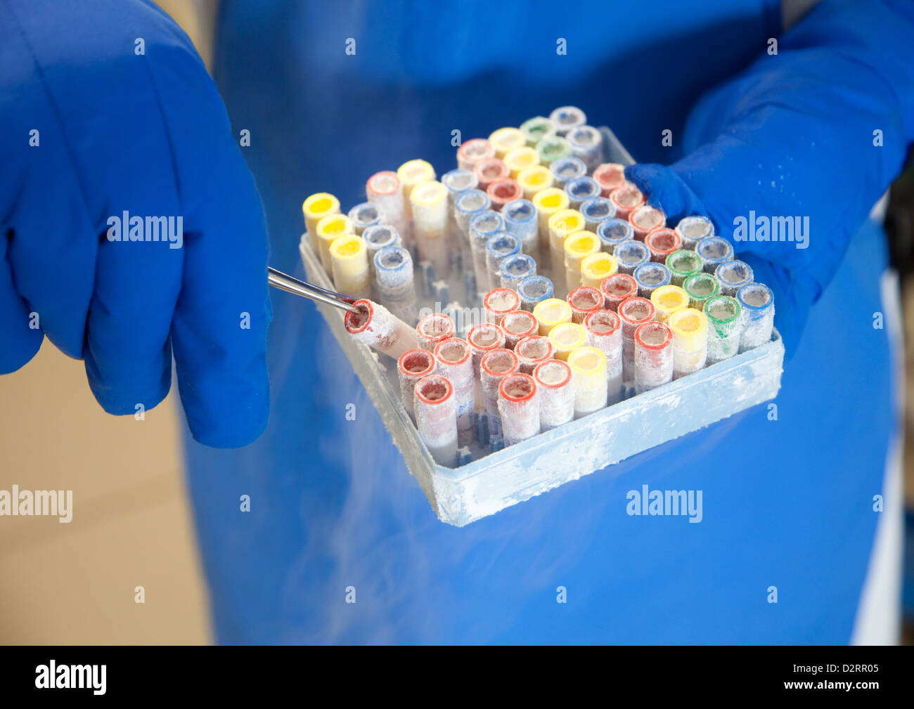 Essen, Germany, stem cell processing in hospital Stock Photo