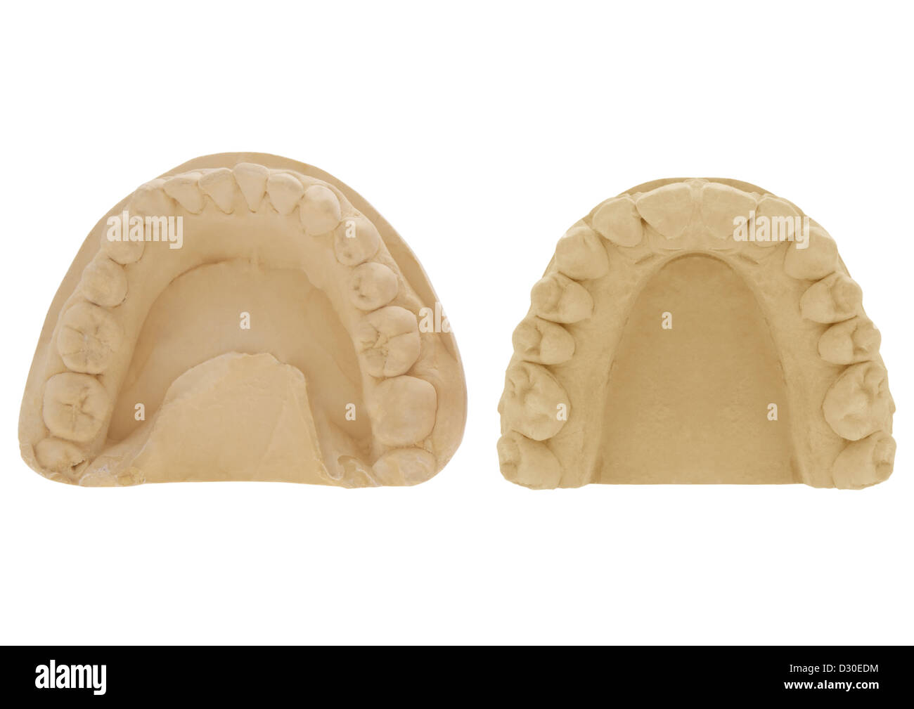909 Teeth Mold Stock Photos, High-Res Pictures, and Images - Getty Images