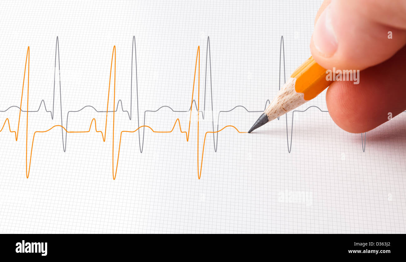Two lines of heart beats Stock Photo Alamy