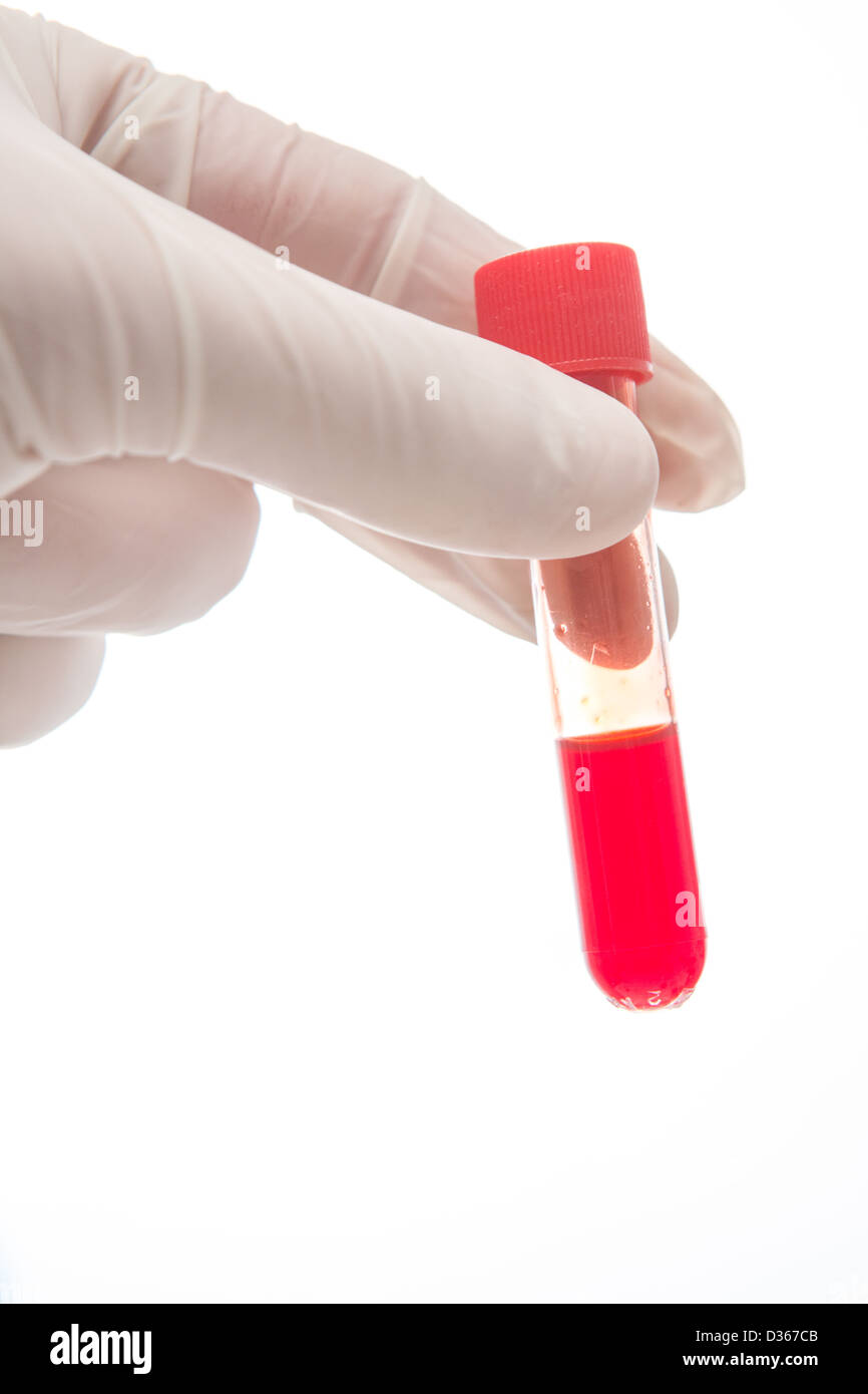 Hand holding vial of blood Stock Photo Alamy