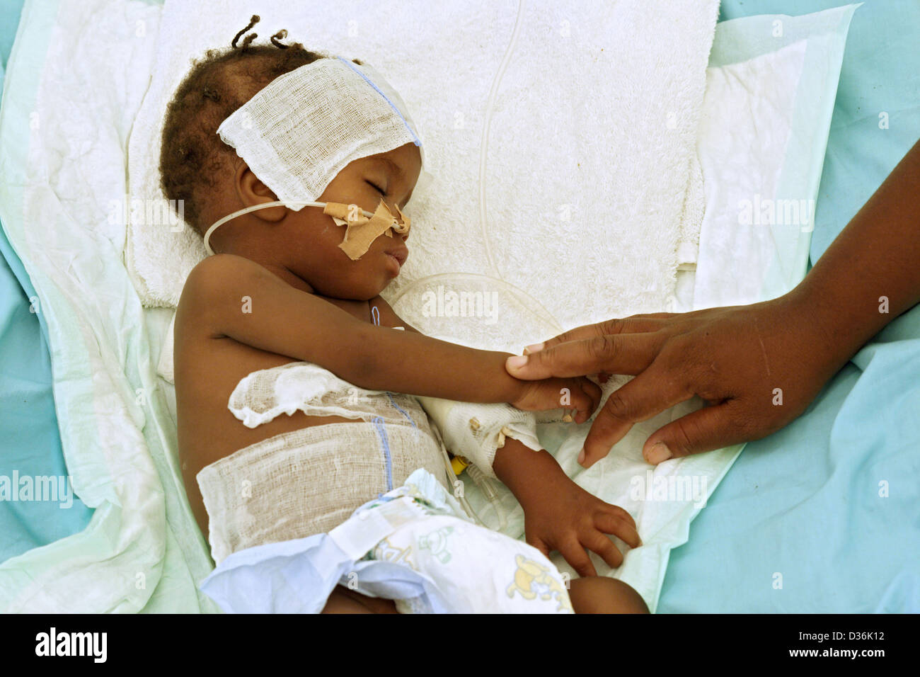 Carrefour, Haiti, sick infant in the intensive care unit of the Field Hospital Stock Photo