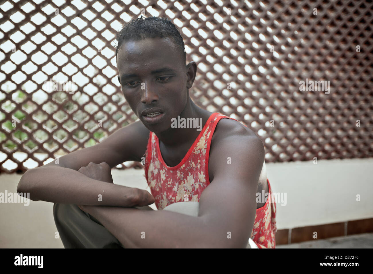 A teenager who had his hand amputated by Al-Shabaab in the turmoil of civil war in Mogadishu, Somalia Stock Photo