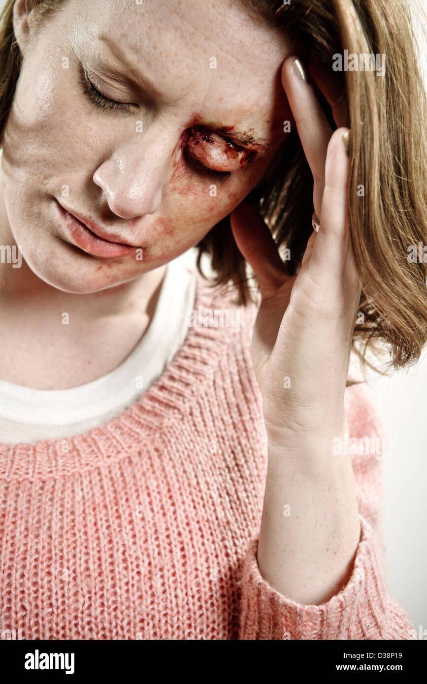 Close up of bruised woman thinking Stock Photo