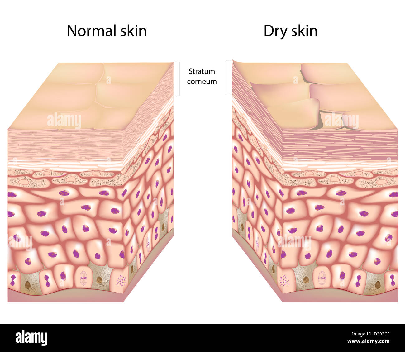 Dry skin Stock Photo