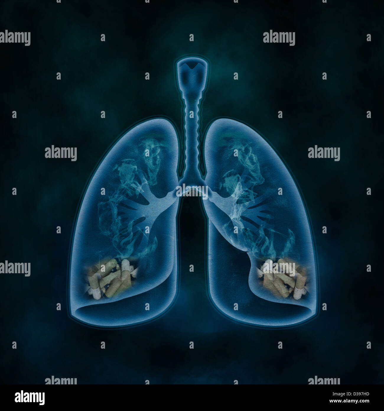Illustration of lungs filled with cigarettes representing concept of