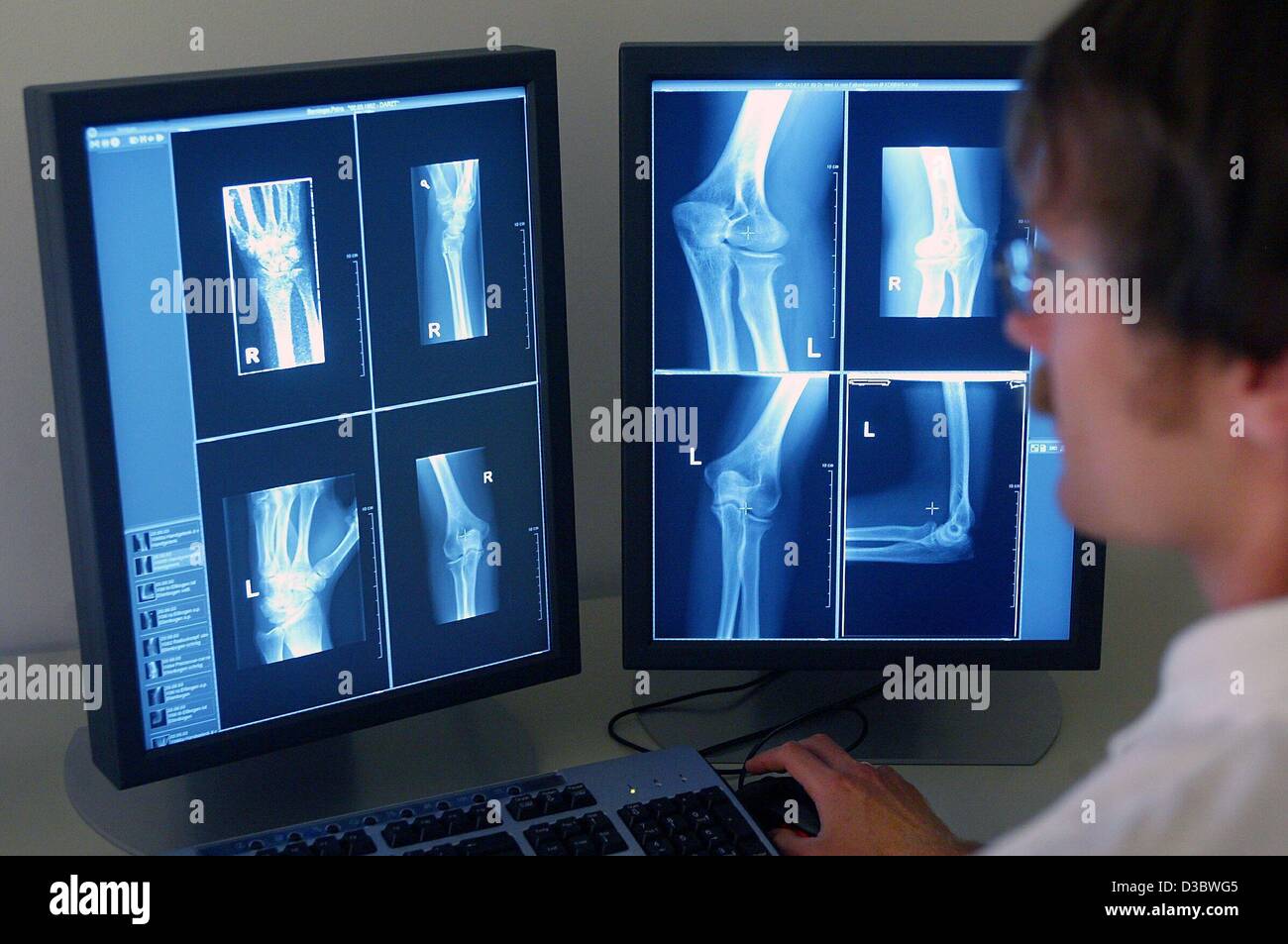 (dpa) - A doctor looks at several digital x-ray photos in the clinic for diagnostic radiology of the new university clinic in Magdeburg, Germany, 22 August 2003. The envisaged healthcare reform of the German government will result in deep cuts in the health and welfare systems. Germany's expensive h Stock Photo
