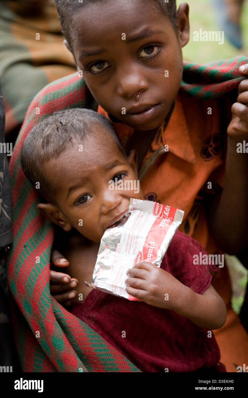 BITENA HEALTH CENTRE, WOLAYITA ZONE, SOUTHERN ETHIOPIA, 20TH AUGUST 2008: A young child eats a sachet of plumpy'nut Stock Photo