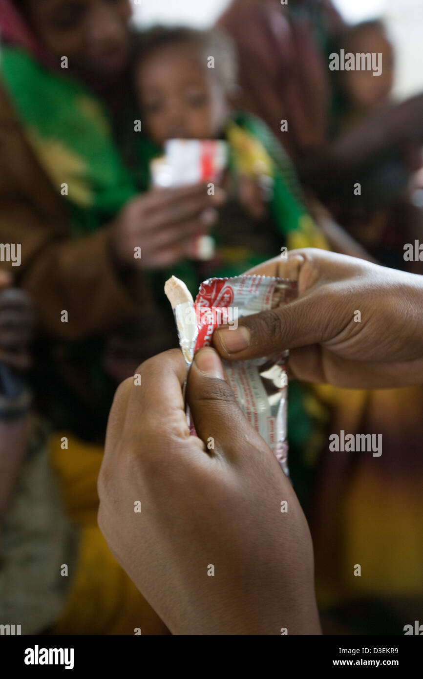 HEALTH CENTRE, WOLAYITA ZONE,  ETHIOPIA, 20TH AUGUST 2008: A malnourished child is given a sachet of plumpy-nut  food supplement Stock Photo