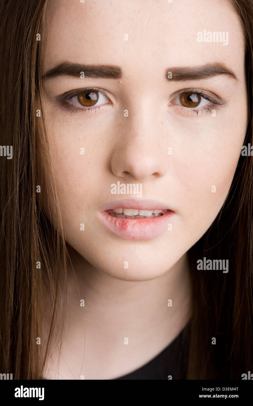 Teenage girl with a cold sore. Stock Photo