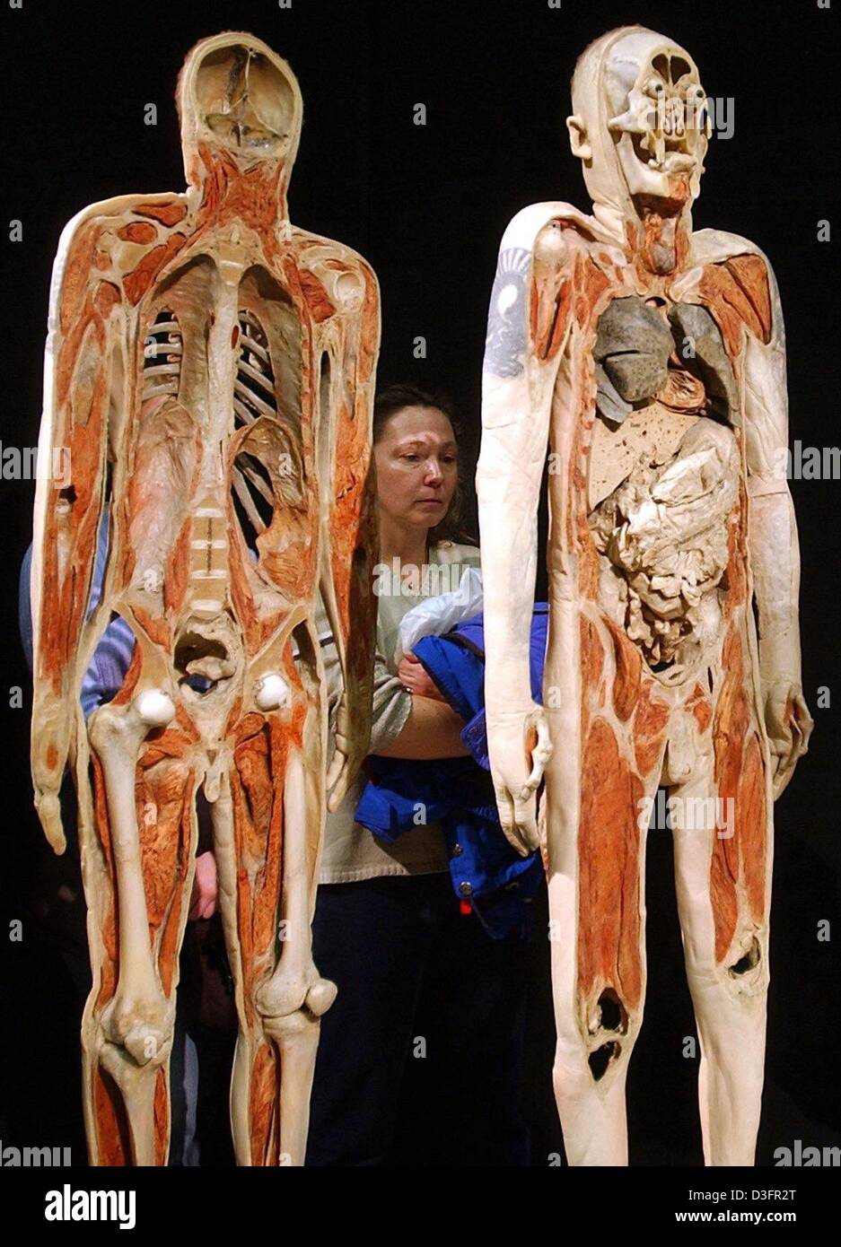 dpa) - A visitor looks at an exhibit at the Body World exhibition in  Munich, Germany, 23 February 2003. After weeks of debates the Bavarian  administrative court approved on 21 February 2003