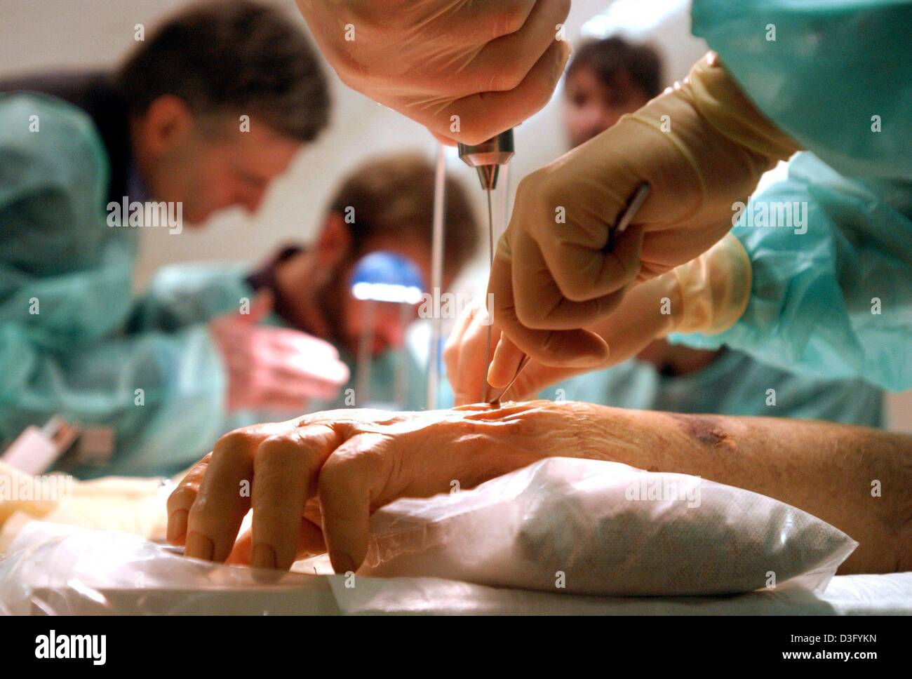 surgery hand plastic surgeons renowned dpa newest practice alamy