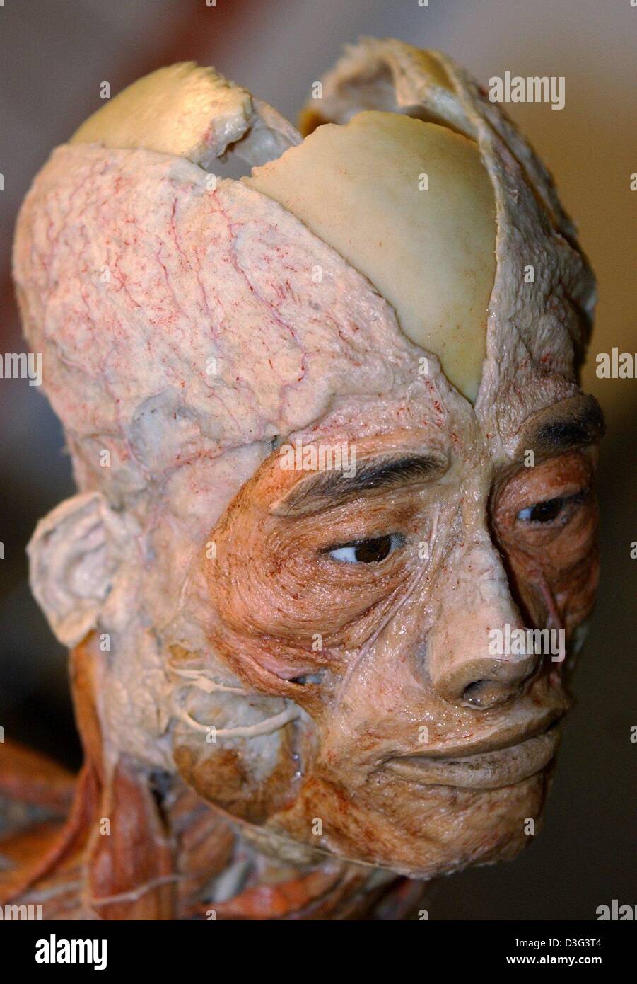 (dpa) - An exhibit from the Body World exhibition in Munich, Germany, 29 November 2002. The Bavarian administrative court approved on 21 February 2003 the controversial exhibition Body Worlds to exhibit in Munich. The physician professor Gunther von Hagens was relieved after the official decision. Stock Photo