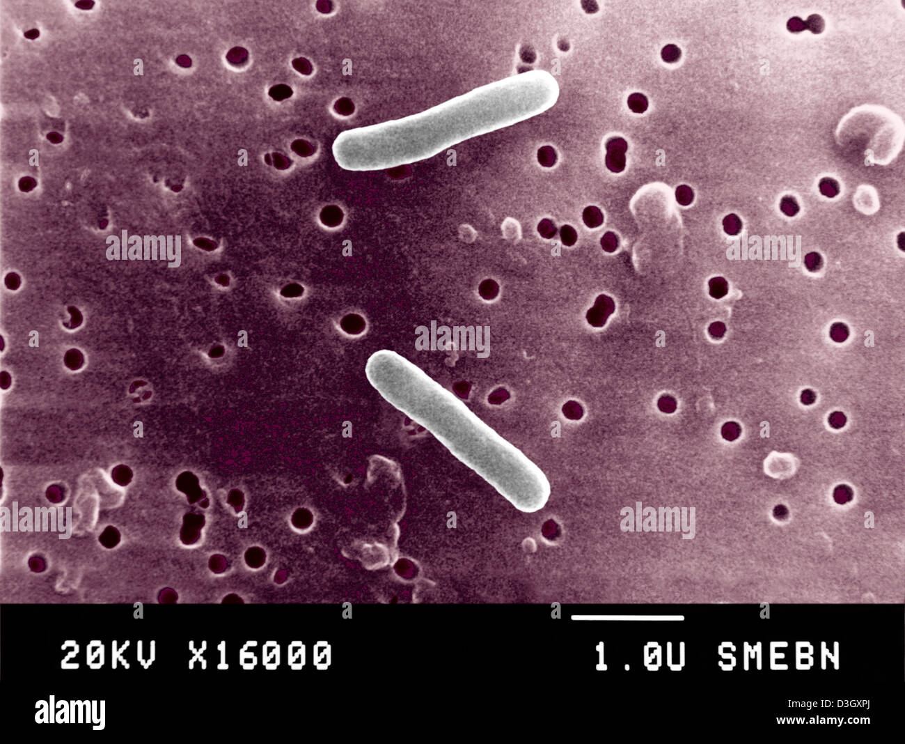 Salmonella Typhi Rose Spots