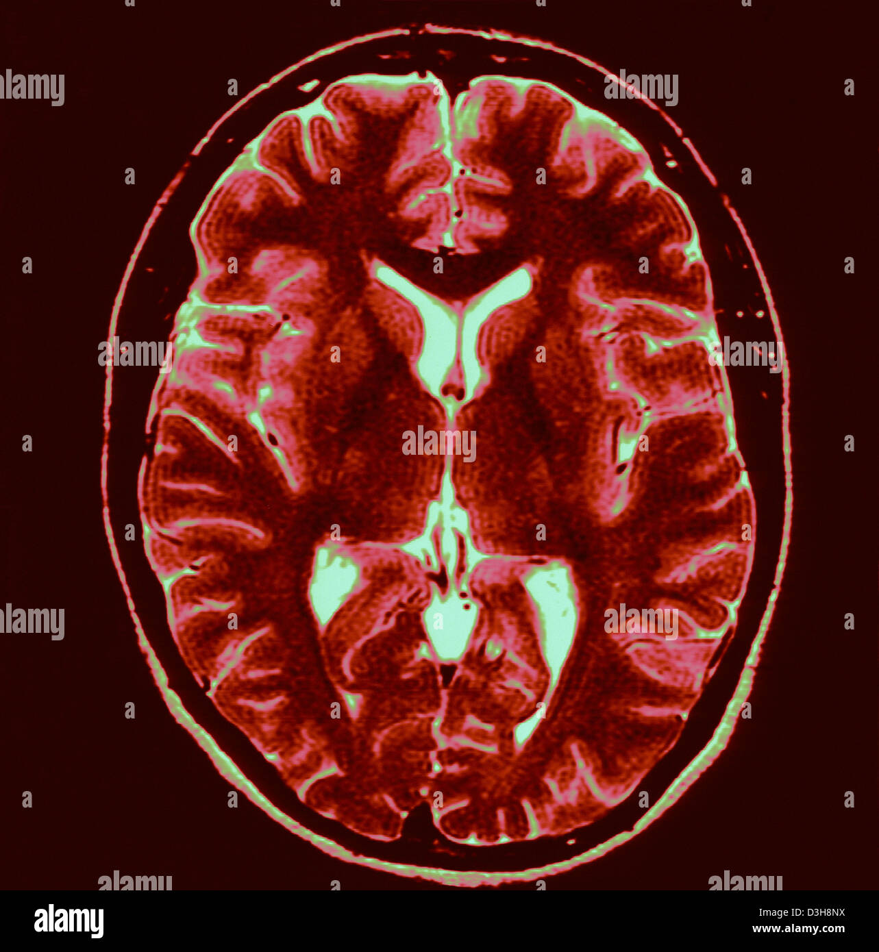 BRAIN, SCAN Stock Photo - Alamy