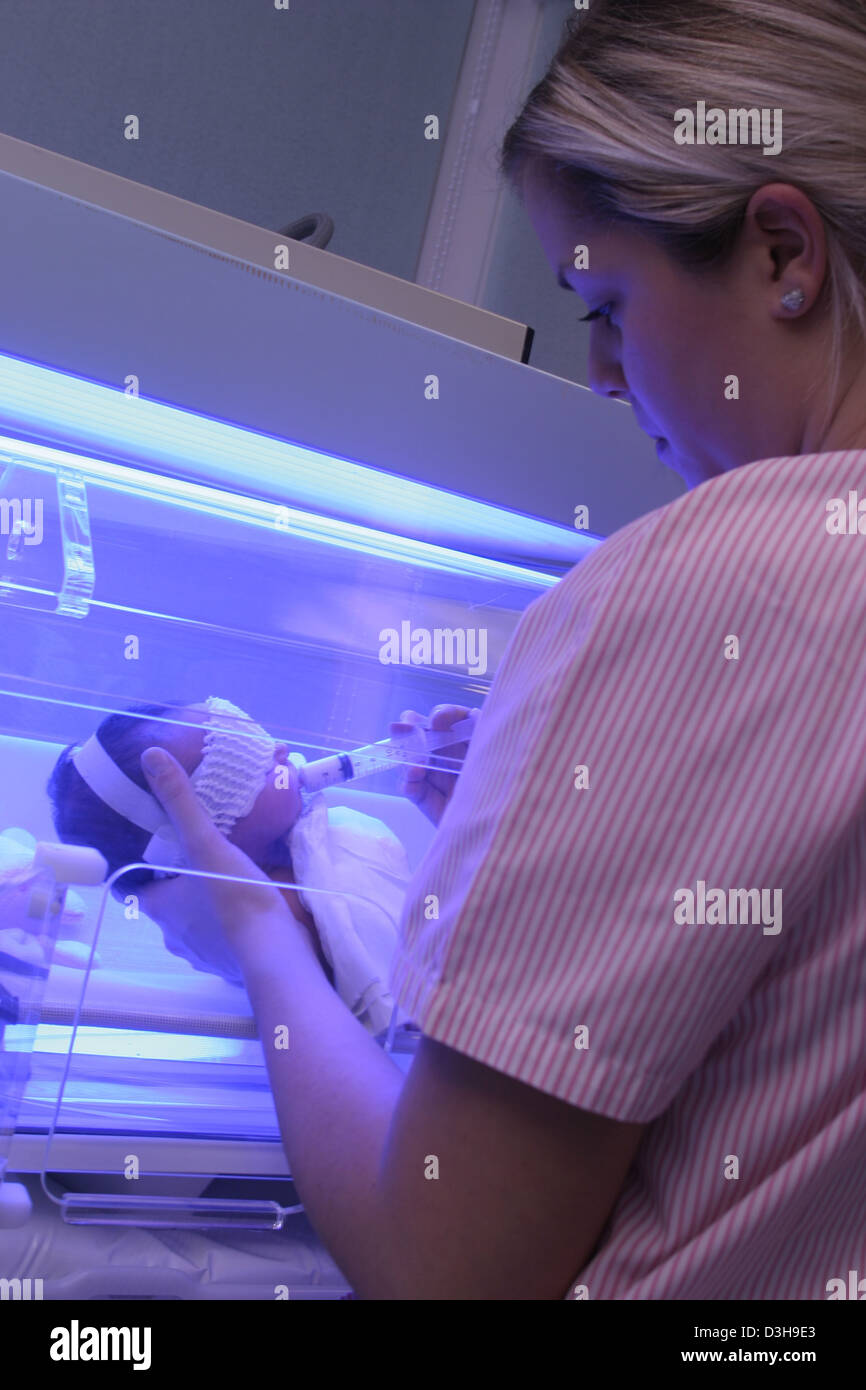 NEONATAL JAUNDICE, PHOTOTHERAPY Stock Photo Alamy