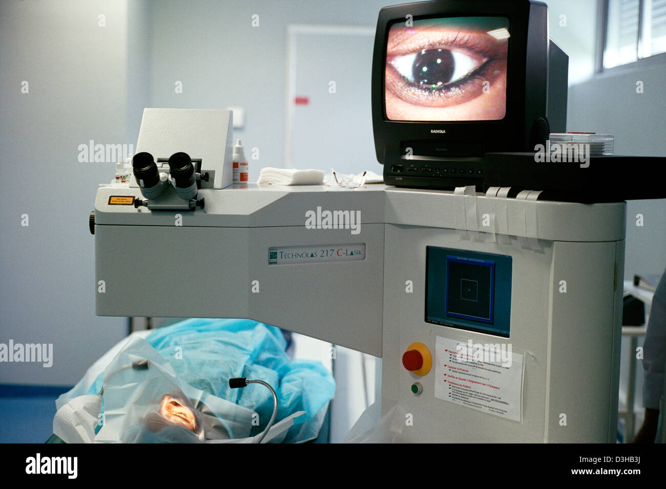 EYE LASER SURGERY Stock Photo Alamy