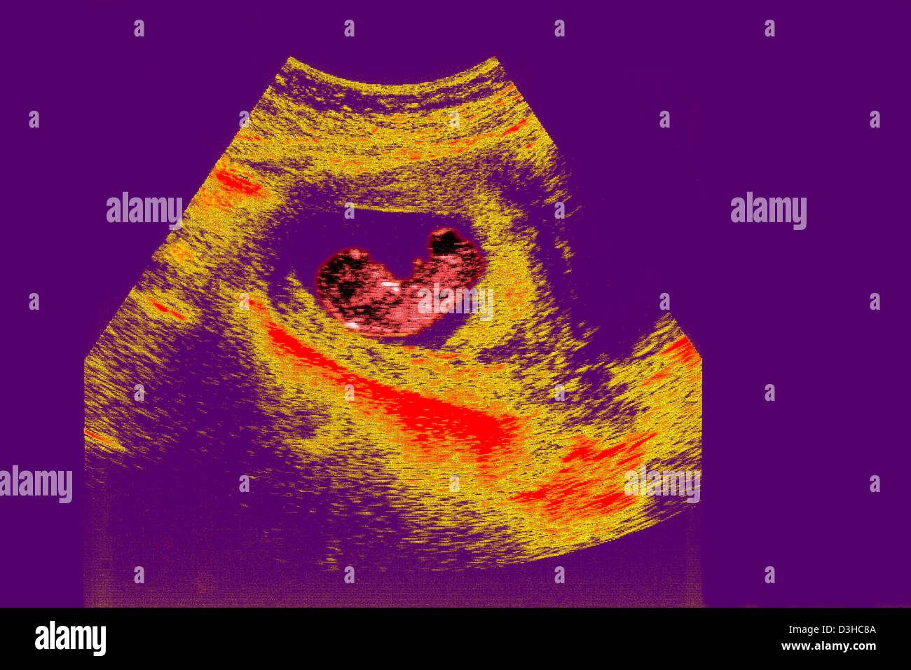 Fetal ultrasound scans hires stock photography and images Alamy