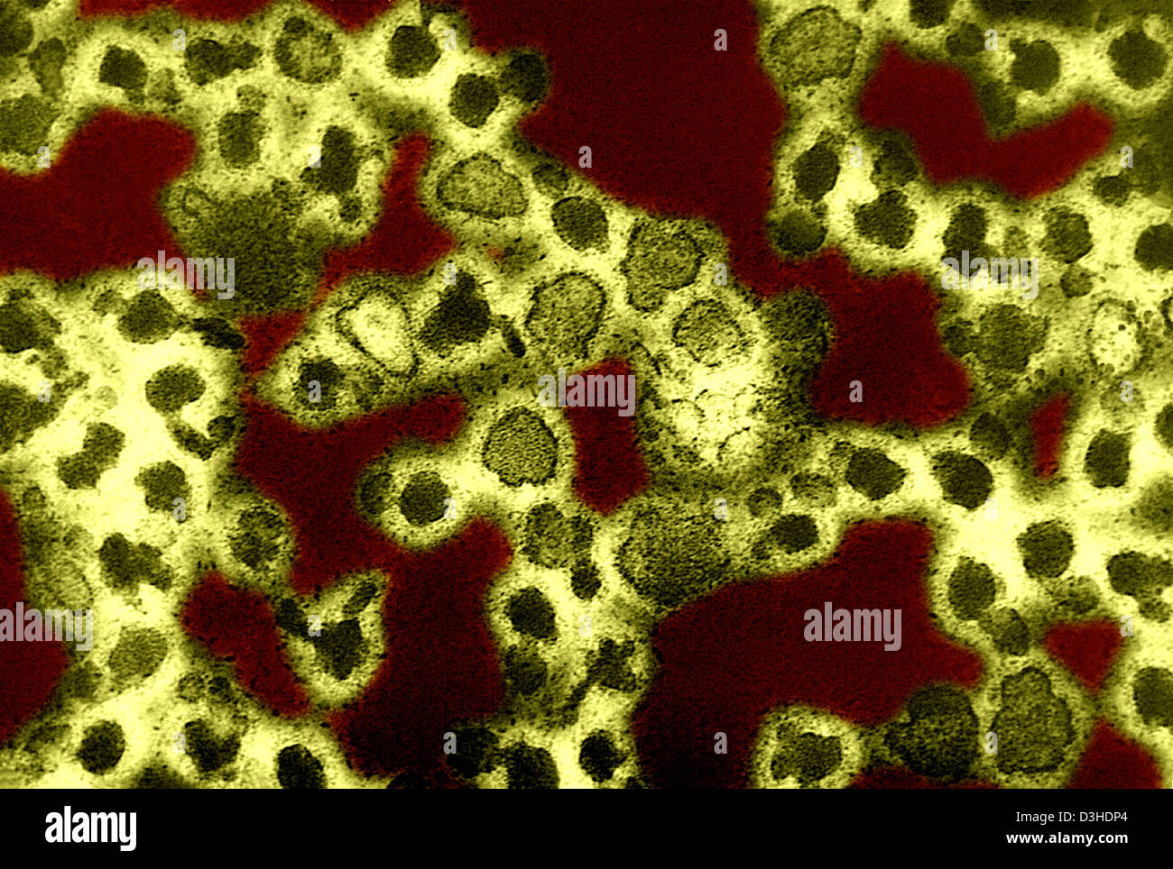 LA CROSSE VIRUS Stock Photo Alamy