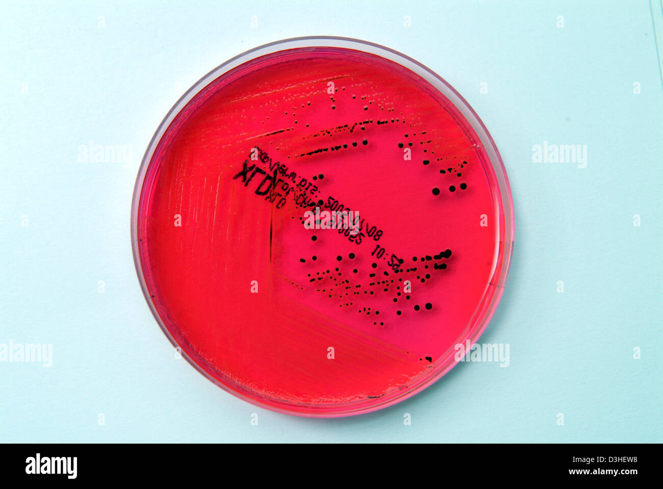 SALMONELLA Stock Photo Alamy