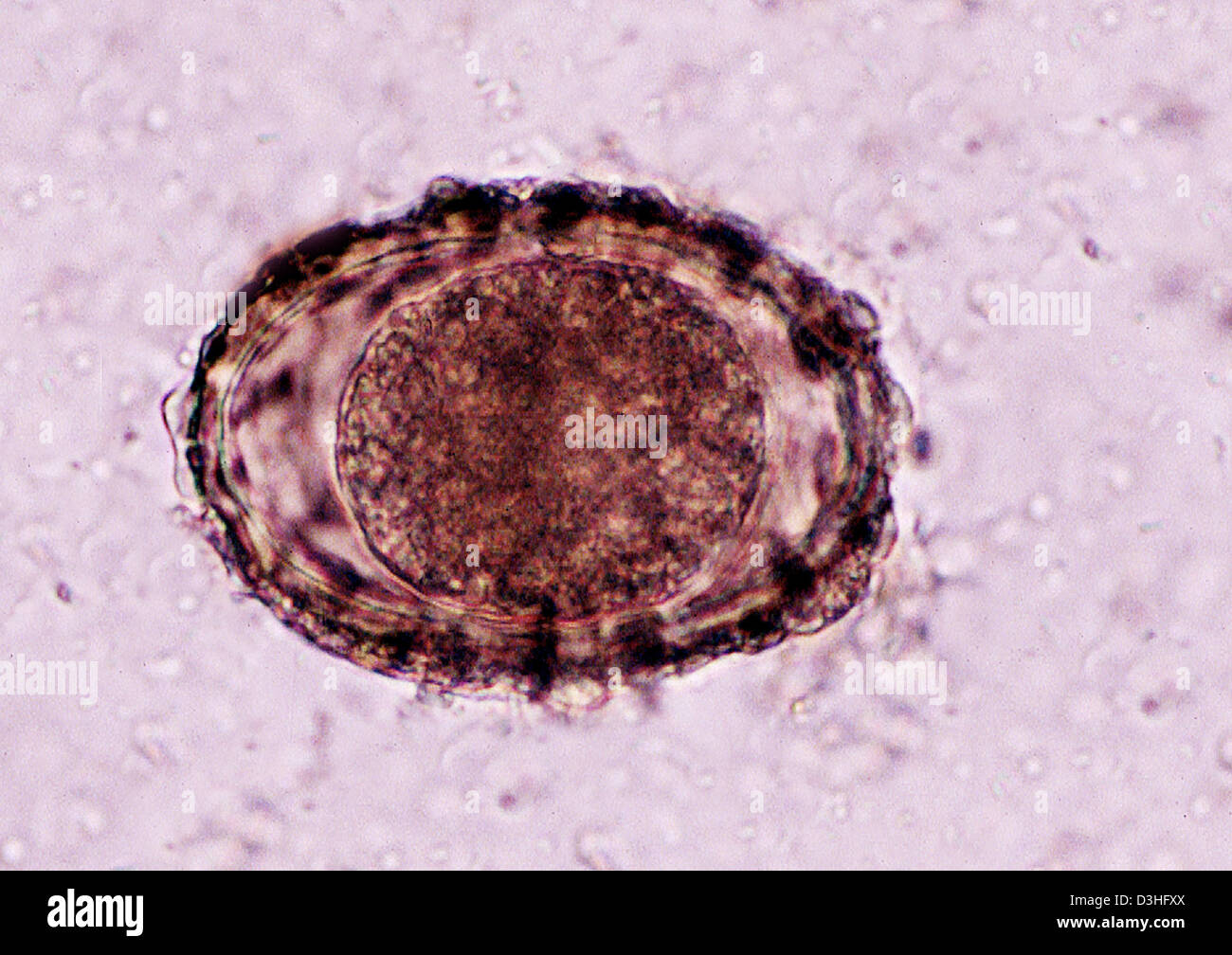 Ascaris High Resolution Stock Photography and Images - Alamy